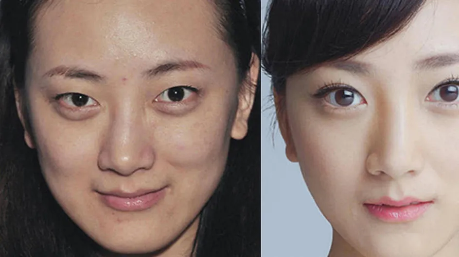 Extreme Plastic Surgery Made These Women Unrecognizable At The Airport