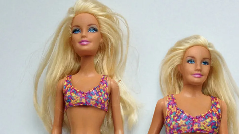 Is The ‘Average’ Acne Barbie Really Necessary?