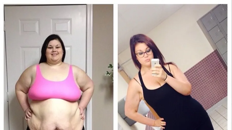 Une jeune femme perd 90 kg et se fait opérer gratuitement
