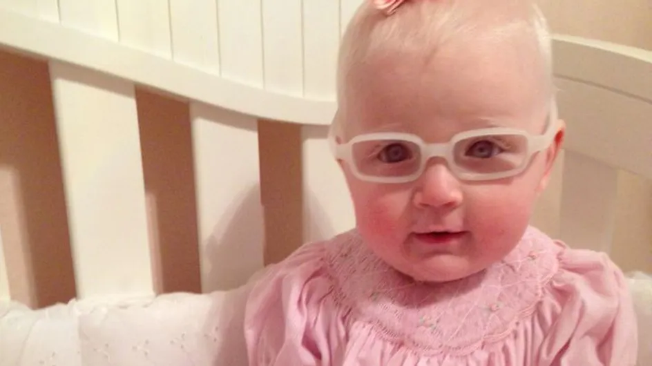 Un bébé atteint d'albinisme voit sa maman pour la première fois (Vidéo)