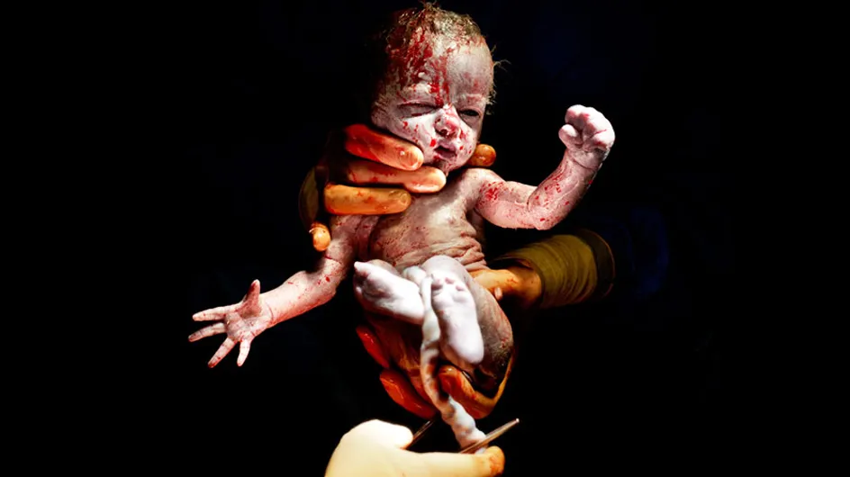 Cuando la vida se mide en segundos: Asombrosas fotografías de bebes justo después de nacer