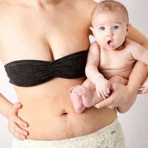 "A Beautiful Body", el proyecto que muestra la belleza real de las mamás