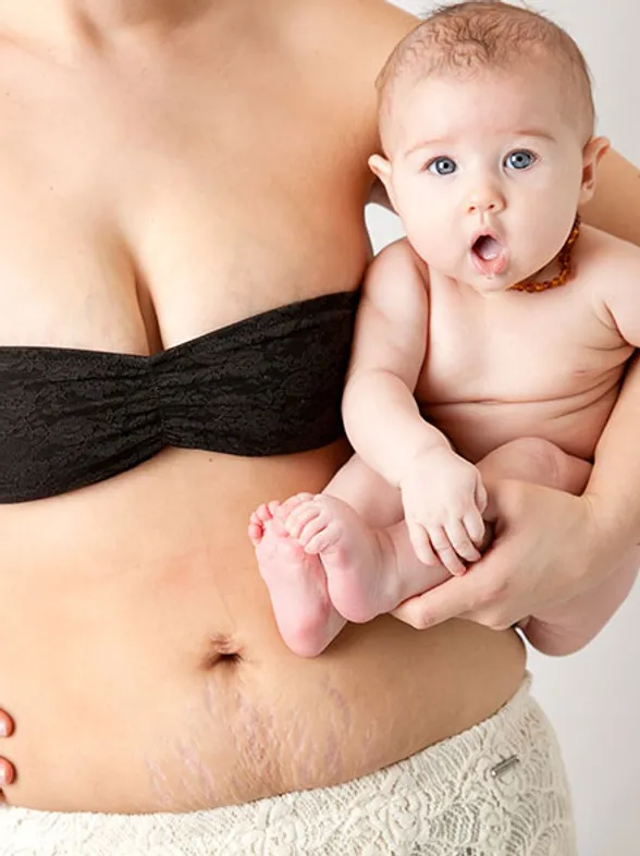 "A Beautiful Body", el proyecto que muestra la belleza real de las mamás