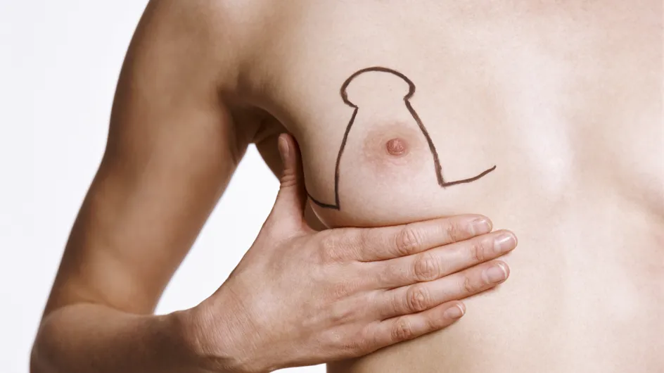 Ptose mammaire : la corriger pour se réconcilier avec son corps