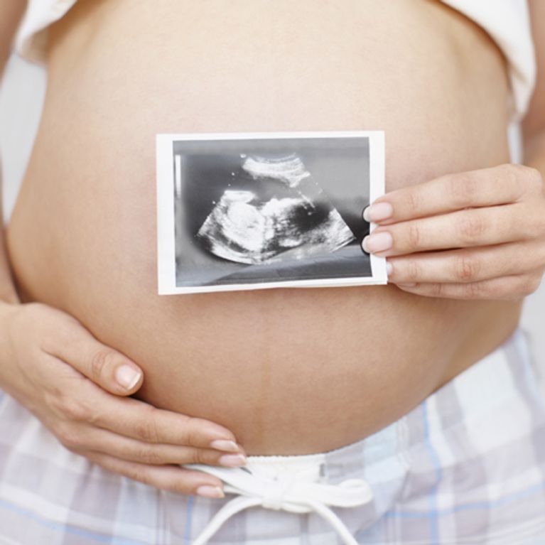 Ultraschall in der Schwangerschaft: Die wichtigsten Infos. 
