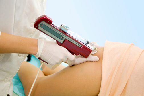 Combate la celulitis con la mesoterapia