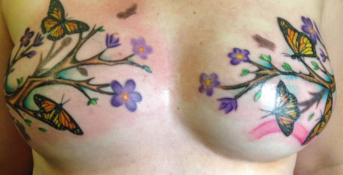 Tattoos gegen die BrustkrebsNarben So mutig zeigen sich diese Frauen