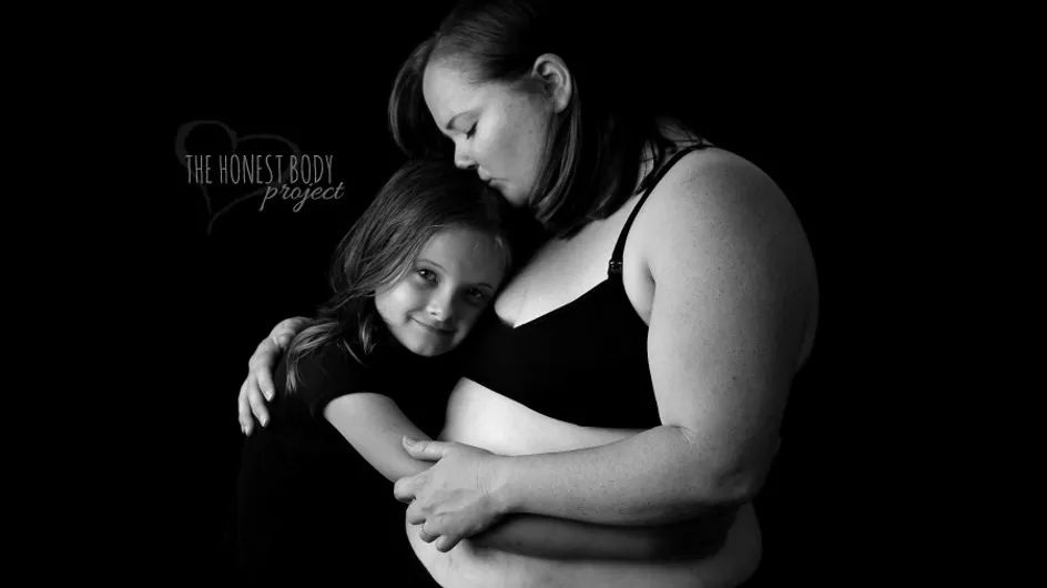 #HonestBodyProject : la série photo qui lutte contre la pression du corps parfait après bébé
