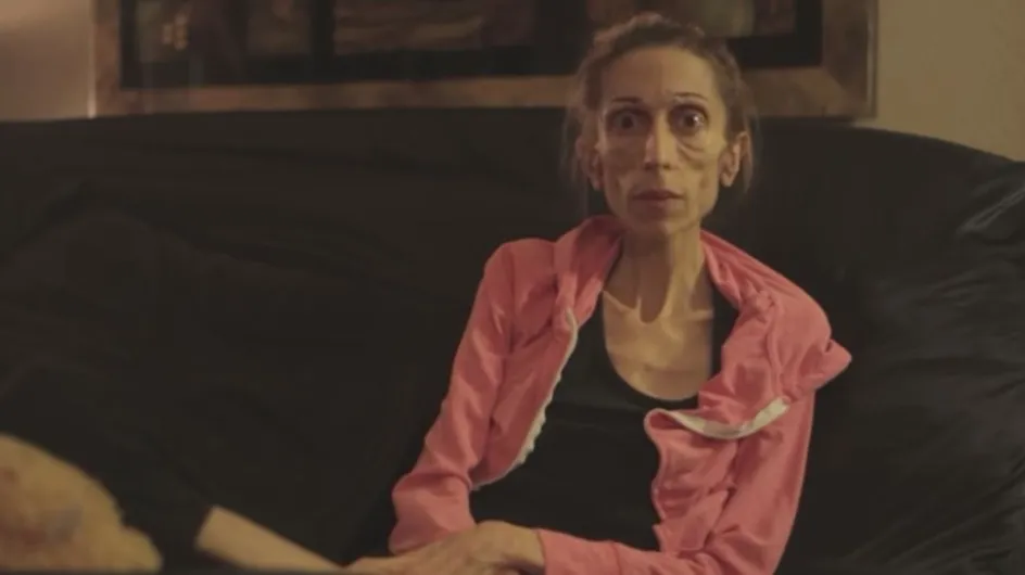 La femme de la semaine : Rachael Farrokh, son long combat contre l'anorexie extrême (Vidéo)