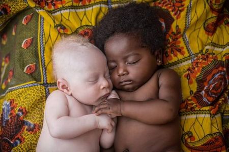 Dos primos de diferente raza se abrazan a la hora de la siesta