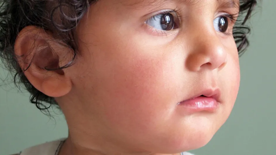 Né sans nez ni yeux, un petit garçon subit une lourde opération pour avoir un nouveau visage (Vidéo)