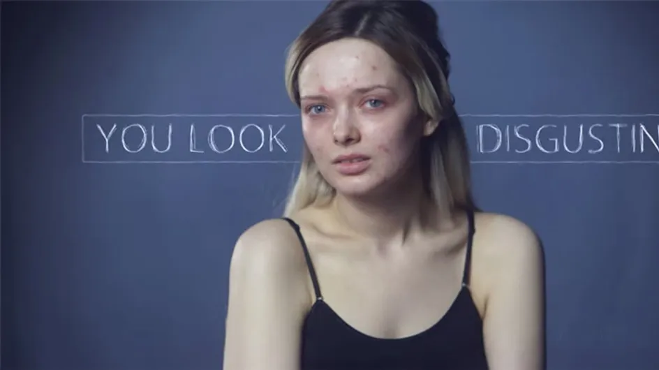 #YouLookDisgusting This Vlogger Has A Powerful Message About Beauty Ideals