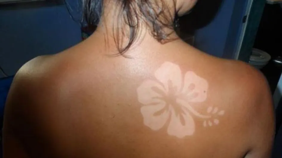 Le #SunBurnArt ou l’art de se créer des tatouages éphémères à partir de coups de soleil