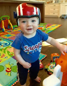 Su bebé debe usar casco por una enfermedad, así que toda la familia adoptó  la moda (FOTOS)
