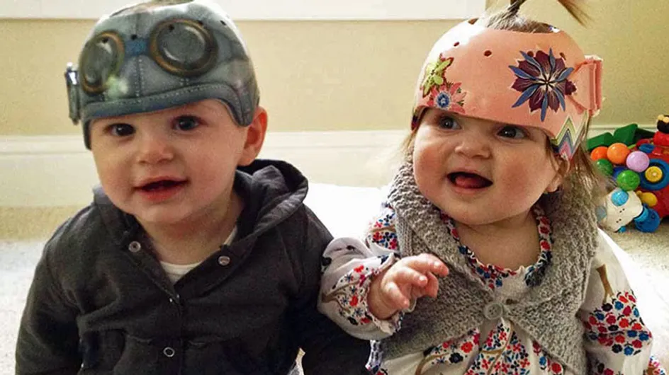 Una artista pinta cascos originales para bebés con síndrome de cabeza plana