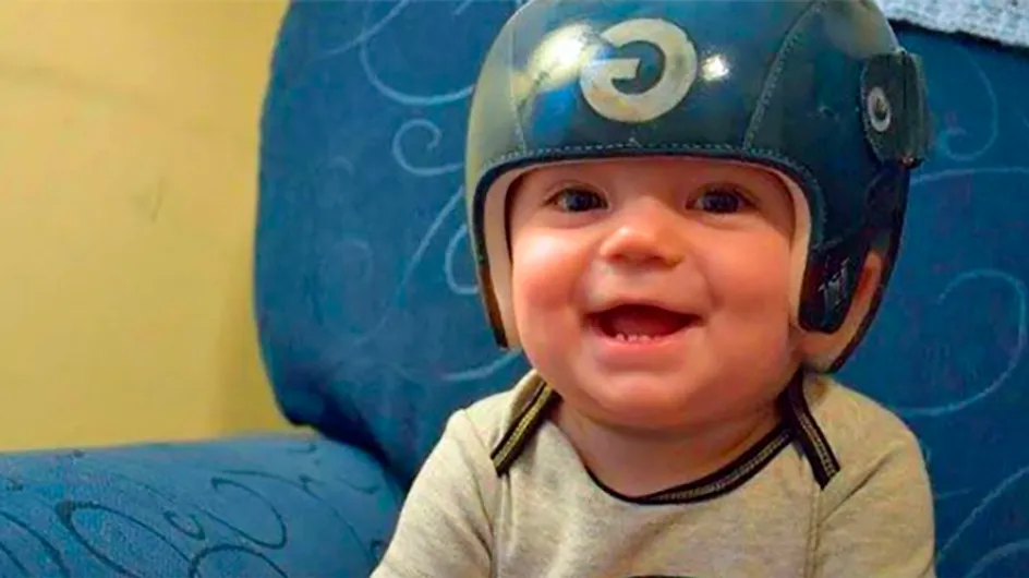 Artista pinta capacetes para bebês com síndrome da cabeça plana