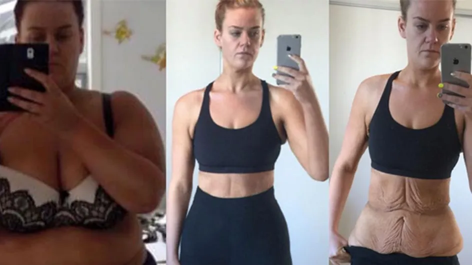 Simone Anderson Shuts Down Haters With Brave Before And After Weight Loss Photos