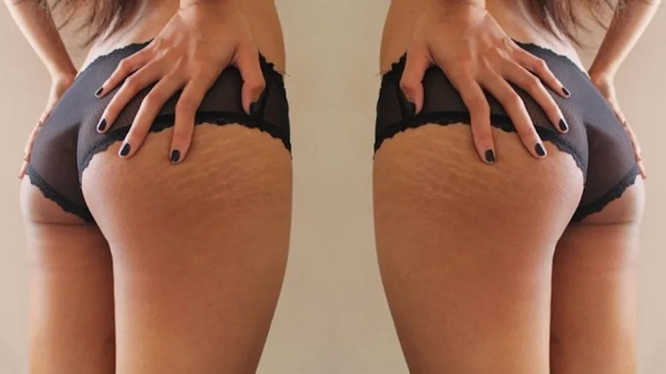 Women Are Celebrating Their Imperfections With #ThighReading