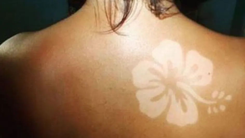 Sun Tattoo: il nuovo trend dell'estate è il tatuaggio solare che spopola sui social