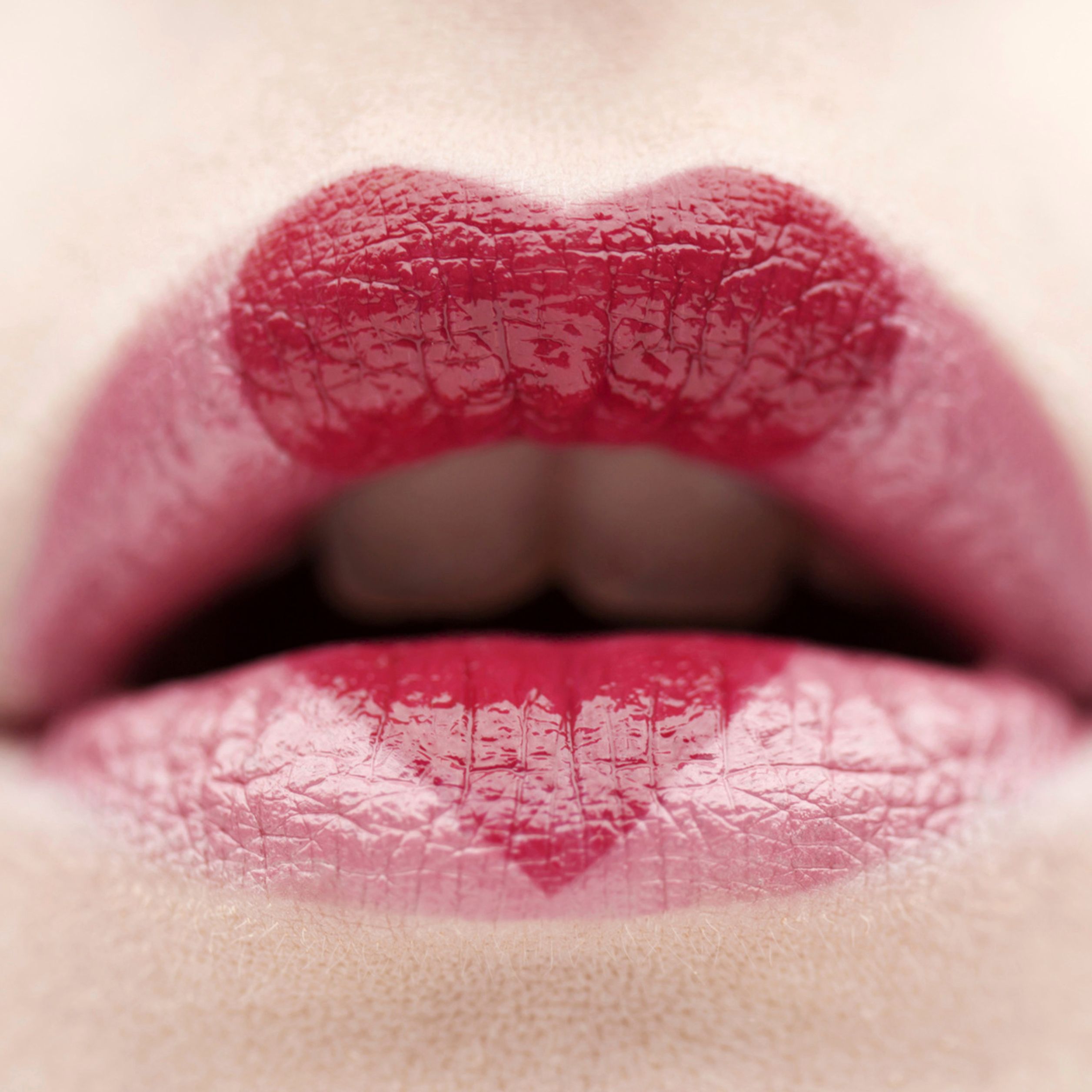 Adiós a los labios agrietados, aprende a prevenirlos y tratarlos