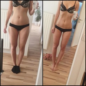 hCG-Diät: vorher/nachher