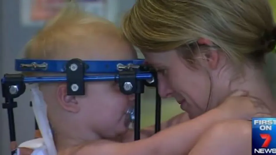 Un bébé de 16 mois survit miraculeusement à une décapitation interne