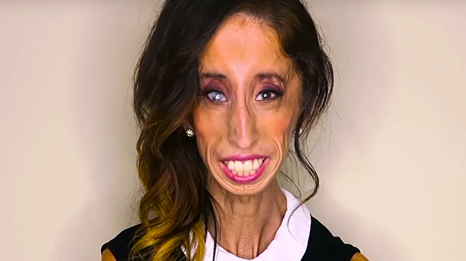 How The World's So-Called 'Ugliest Woman' Turned Online Hate Into The Most Inspirational Campaign Ever
