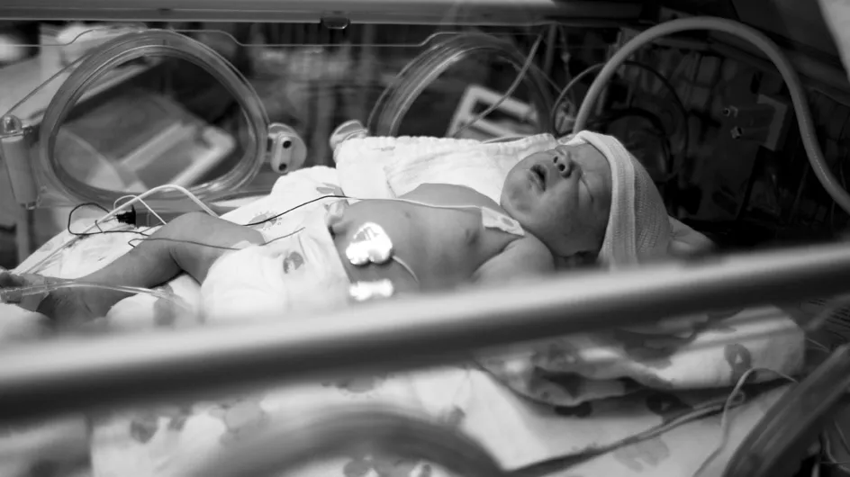 17 retratos del antes y el después de bebés prematuros que sobrevivieron a las adversidades