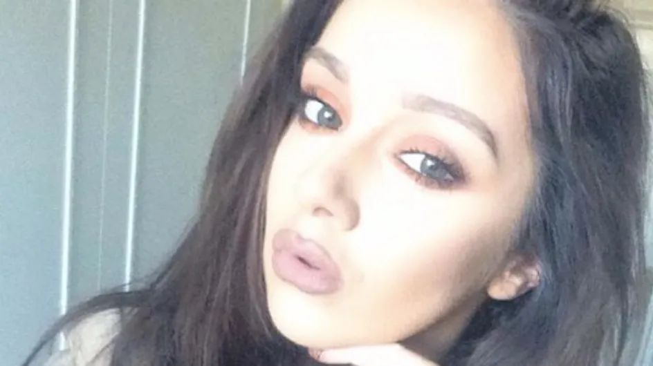 Une blogueuse dévoile ses lèvres ratées après des injections pour ressembler à Kylie Jenner (Photos)