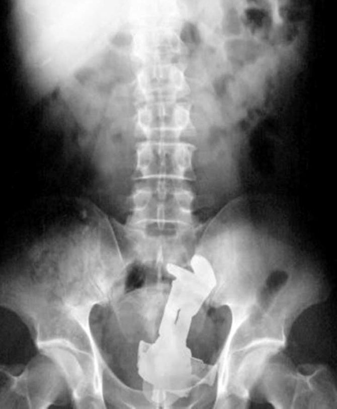¿BUZZ LIGHTYEAR?