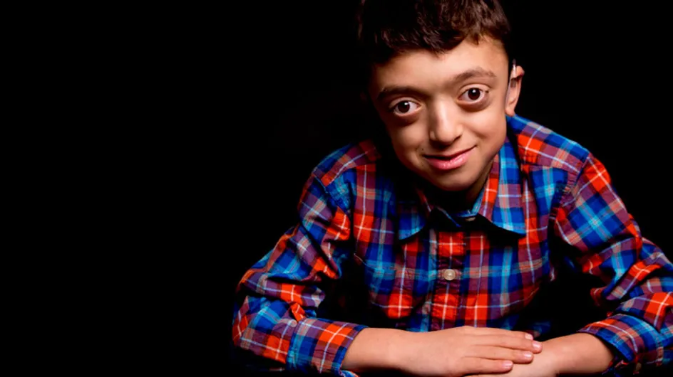 Las fotografías de niños con enfermedades raras que nos enseñan a mirar más allá de su condición