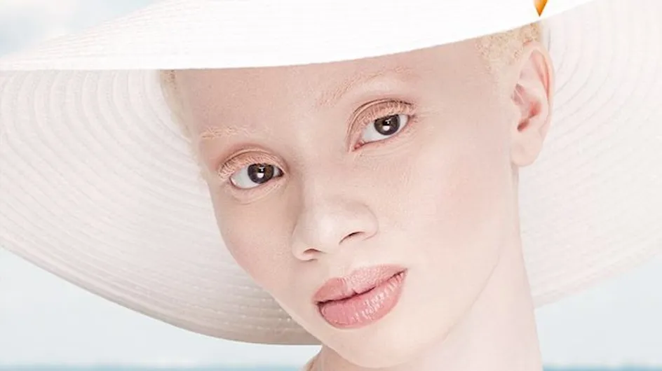 Les mannequins albinos qui ont conquis le monde de la mode (Photos)