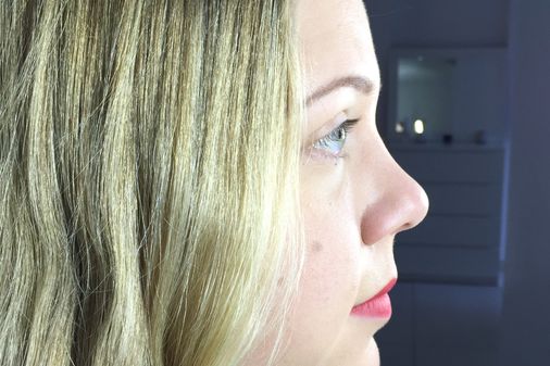 Wimpernverlängerung Vorher