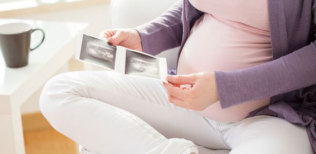 Geburt Per Kaiserschnitt Wir Klaren Die Wichtigsten Fragen Zum Ablauf