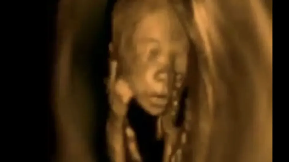 [Vídeo] ¡Increíble pero cierto! Los movimientos de un feto dentro del vientre materno