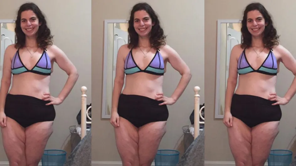 This Woman's First Bikini Photo Has Gone Viral For All The Right Reasons