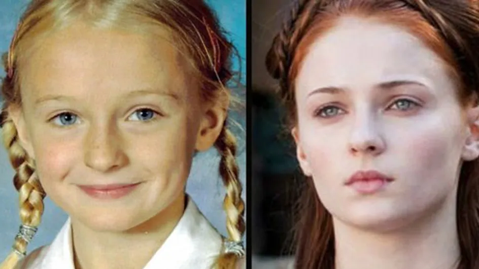 Les acteurs de Games of Thrones avant et après