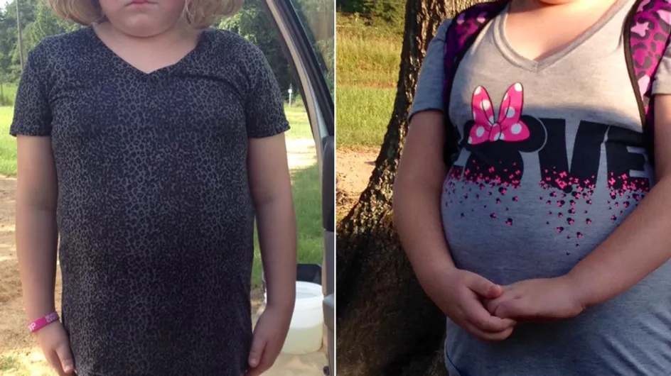 Unfassbar: Diese 9-Jährige wurde wegen ihres Gewichts vom Unterricht ausgeschlossen