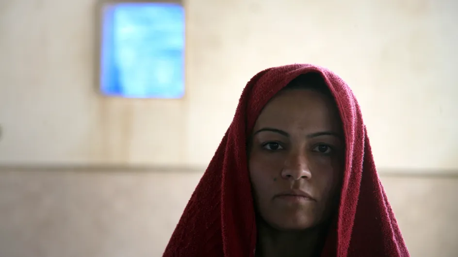 Esclave sexuelle de Daesh, elle se brûle le visage pour échapper au viol (Photos)