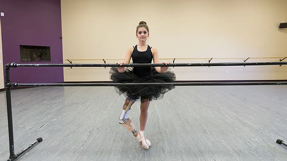 Ballerina mit Handikap: Ihre Prothese hält sie nicht davon ab, ihren Traum zu leben