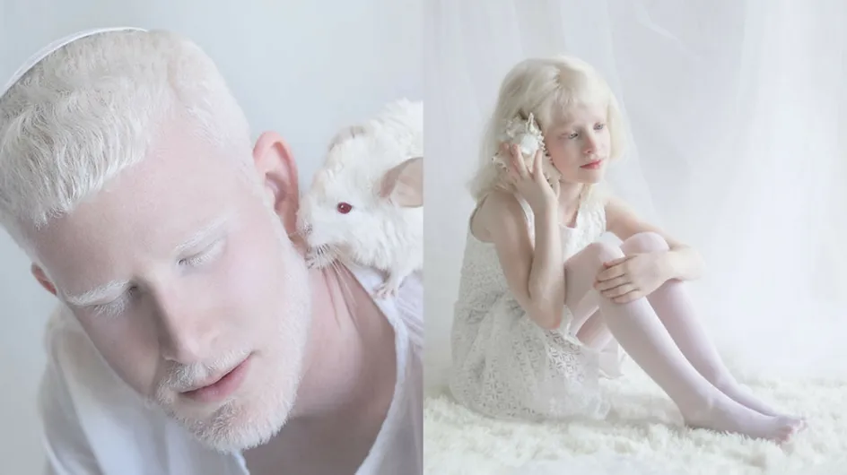 Cette photographe montre la beauté captivante de l'albinisme (photos)