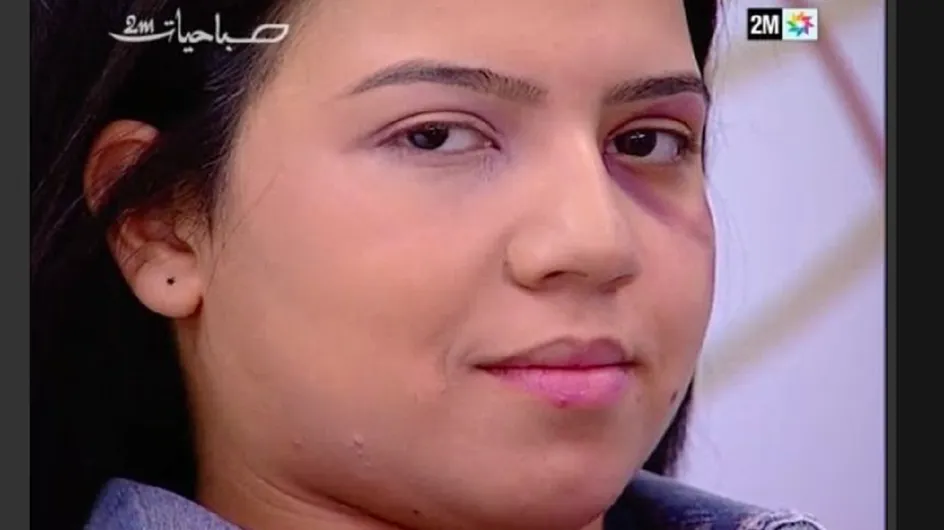 Un tuto maquillage spécial femmes battues au Maroc indigne les internautes (Vidéo)