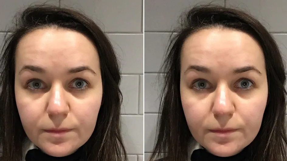 I Tried Yoga For My Face And It Made My Skin Feel Five Years Younger