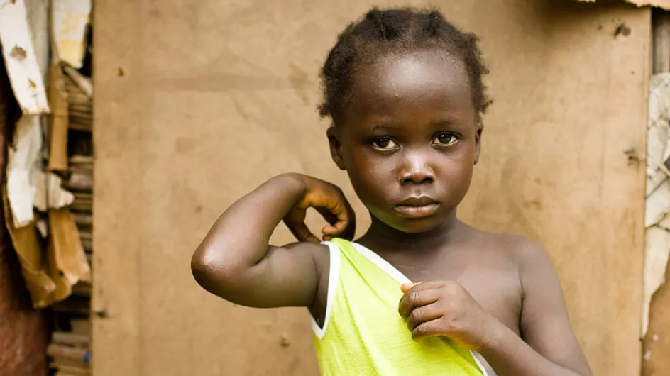 Planchado de senos, la tortura que aún sufren algunas niñas en Camerún
