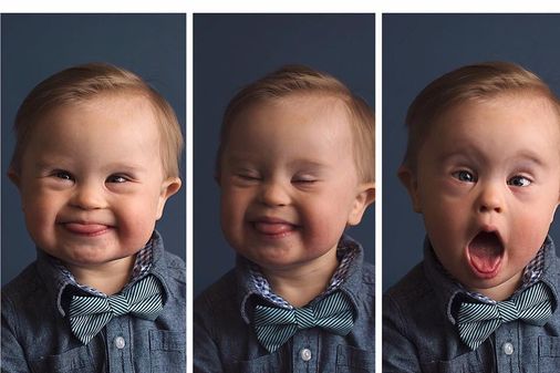 Asher Nash, trisomique, mais avant tout : super mignon