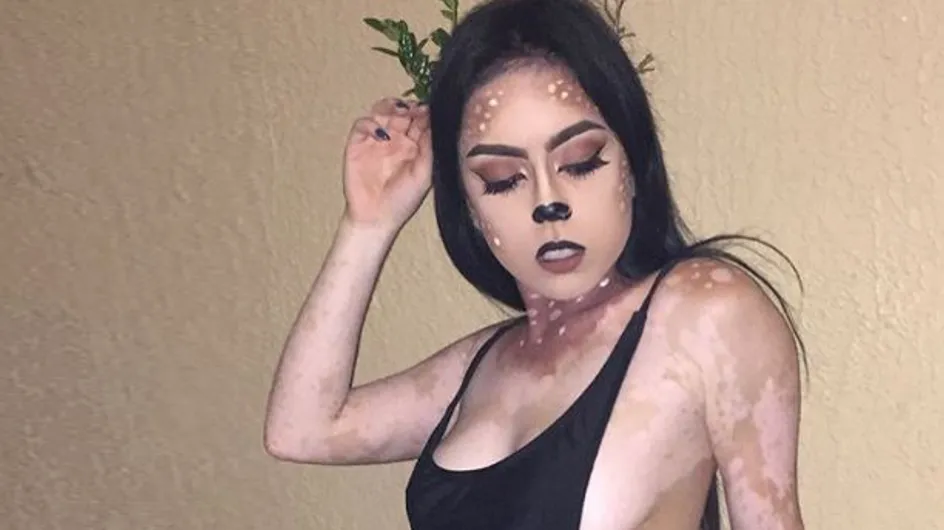 Atteinte de vitiligo, elle transforme son corps en une véritable œuvre d'art (photos)