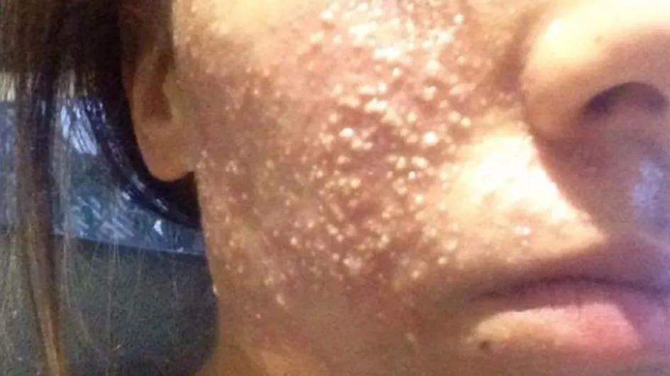 This Woman's Eyelash Extensions Gave Her A Nasty Skin Infection And It Should Be A Warning To Us All