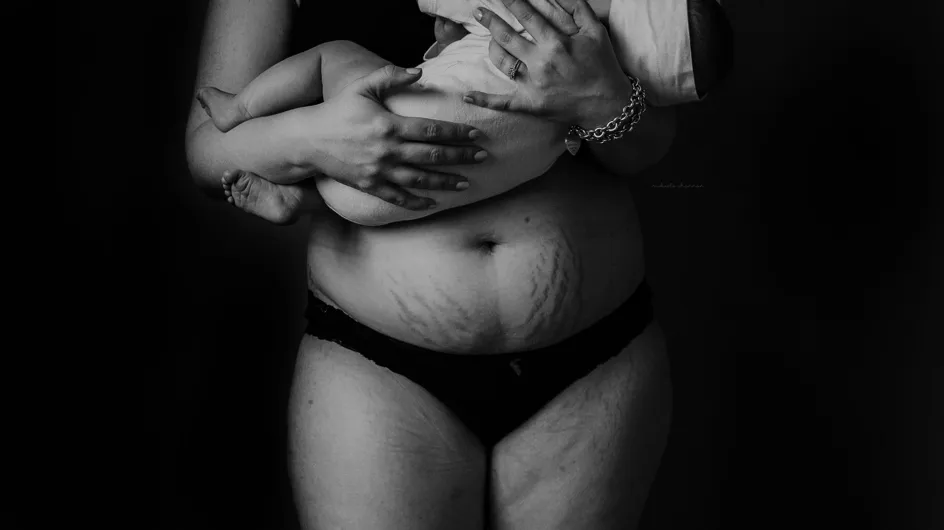 Le corps après l’accouchement, des photos poignantes