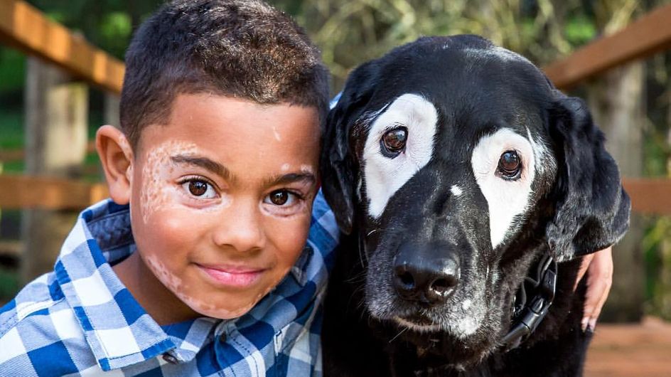 Er schämt sich für sein Aussehen bis er Hund Rowdy kennenlernt