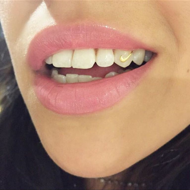 Jewellery For Your Teeth Is Coming Back In A Big Way